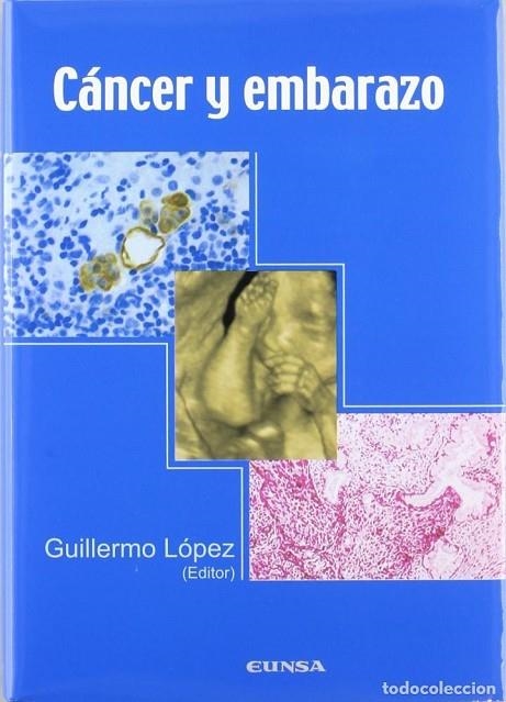 CANCER Y EMBARAZO | 9788431324490 | LOPEZ, GUILLERMO (ED) | Llibreria La Gralla | Llibreria online de Granollers