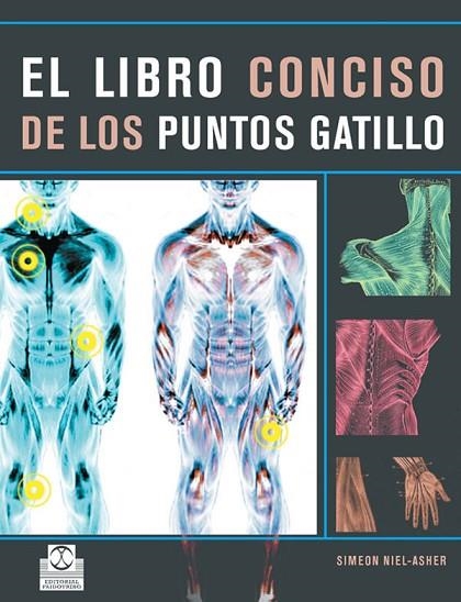 LIBRO CONCISO DE LOS PUNTOS GATILLO, EL | 9788480191319 | NIEL ASHER, SIMEON | Llibreria La Gralla | Llibreria online de Granollers