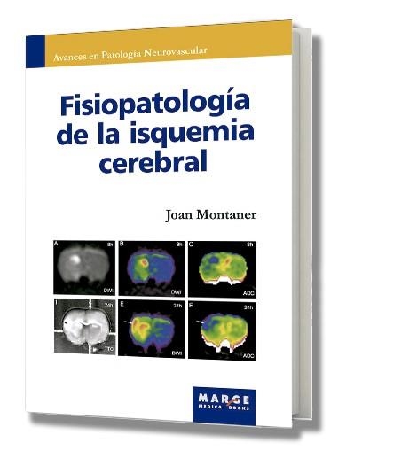 FISIOPATOLOGIA DE LA ISQUEMIA CEREBRAL | 9788486684839 | MONTANER, JOAN | Llibreria La Gralla | Llibreria online de Granollers