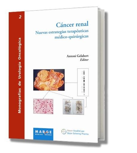 CANCER RENAL. NUEVAS ESTRATEGIAS TERAPEUTICAS MEDICO QUIRURG | 9788492442126 | GELABERT, ANTONI | Llibreria La Gralla | Llibreria online de Granollers