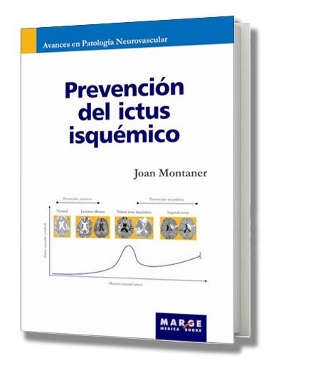 PREVENCION DEL ICTUS ISQUEMICO | 9788492442089 | MONTANER, JOAN | Llibreria La Gralla | Llibreria online de Granollers