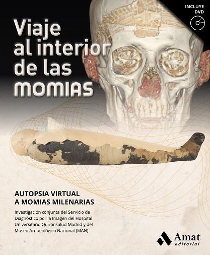 VIAJE AL INTERIOR DE LAS MOMIAS | 9788417208769 | SERVICIO DE DIAGNÓSTICO POR LA IMAGEN DEL HOSPITAL UNIVERSITARIO QUIRÓNSALUD MADRID/MUSEO ARQUEOLÓGI | Llibreria La Gralla | Llibreria online de Granollers